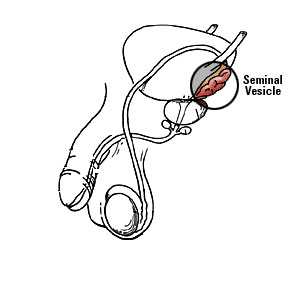 pullout diagram of seminal vesicle
