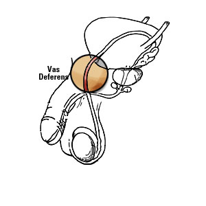 Diagram of the vas deferens in relation to penis